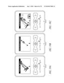 SYSTEMS AND METHODS FOR JOINT REPLACEMENT diagram and image