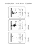 SYSTEMS AND METHODS FOR JOINT REPLACEMENT diagram and image