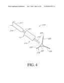 HIP SURGERY SYSTEMS AND METHODS diagram and image