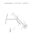 HIP SURGERY SYSTEMS AND METHODS diagram and image