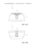 HIP SURGERY SYSTEMS AND METHODS diagram and image