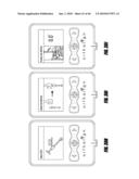 HIP SURGERY SYSTEMS AND METHODS diagram and image