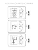 HIP SURGERY SYSTEMS AND METHODS diagram and image