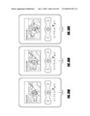 HIP SURGERY SYSTEMS AND METHODS diagram and image