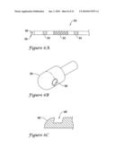 Apparatus and Method for Subcutaneous Electrode Insertion diagram and image