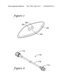 Apparatus and Method for Subcutaneous Electrode Insertion diagram and image