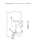 Apparatus and Method for Subcutaneous Electrode Insertion diagram and image