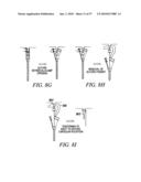 DEVICES, SYSTEMS AND METHODS FOR TISSUE REPAIR diagram and image