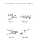 DEVICES, SYSTEMS AND METHODS FOR TISSUE REPAIR diagram and image