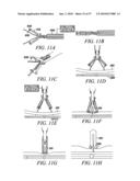 DEVICES, SYSTEMS AND METHODS FOR TISSUE REPAIR diagram and image