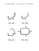 DEVICES, SYSTEMS AND METHODS FOR TISSUE REPAIR diagram and image