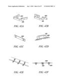 DEVICES, SYSTEMS AND METHODS FOR TISSUE REPAIR diagram and image