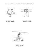 DEVICES, SYSTEMS AND METHODS FOR TISSUE REPAIR diagram and image