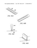 DEVICES, SYSTEMS AND METHODS FOR TISSUE REPAIR diagram and image