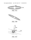 DEVICES, SYSTEMS AND METHODS FOR TISSUE REPAIR diagram and image