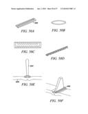 DEVICES, SYSTEMS AND METHODS FOR TISSUE REPAIR diagram and image