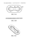 DEVICES, SYSTEMS AND METHODS FOR TISSUE REPAIR diagram and image