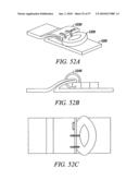 DEVICES, SYSTEMS AND METHODS FOR TISSUE REPAIR diagram and image