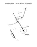 DEVICE FOR DILATING THE URETHRA OF THE BODY OF A PATIENT AND DEVICE FOR REMOVING PROSTATE TISSUE diagram and image