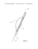 DEVICE FOR DILATING THE URETHRA OF THE BODY OF A PATIENT AND DEVICE FOR REMOVING PROSTATE TISSUE diagram and image