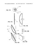 DEVICE FOR DILATING THE URETHRA OF THE BODY OF A PATIENT AND DEVICE FOR REMOVING PROSTATE TISSUE diagram and image