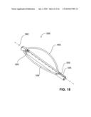 DEVICE FOR DILATING THE URETHRA OF THE BODY OF A PATIENT AND DEVICE FOR REMOVING PROSTATE TISSUE diagram and image