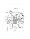 Technique for Adjusting the Locus of Excitation of Electrically Excitable Tissue diagram and image