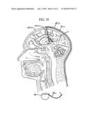 Technique for Adjusting the Locus of Excitation of Electrically Excitable Tissue diagram and image