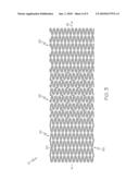 Stent with Graduated Stiffness diagram and image