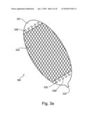 SOFT TISSUE FIXATION DEVICES diagram and image