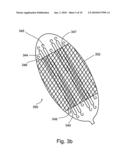 SOFT TISSUE FIXATION DEVICES diagram and image