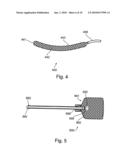 SOFT TISSUE FIXATION DEVICES diagram and image