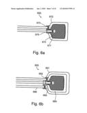 SOFT TISSUE FIXATION DEVICES diagram and image