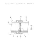 ANTI-TURN-BACK TWIST MOP diagram and image