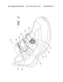 REEL BASED LACING SYSTEM diagram and image