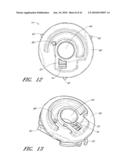 REEL BASED LACING SYSTEM diagram and image