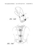 REEL BASED LACING SYSTEM diagram and image