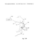 NASAL AND ORAL CANNULA HAVING TWO CAPABILITIES AND METHOD OF PRODUCING SAME diagram and image