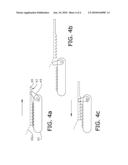 ACTIVE MATERIAL ACTUATED HEADREST UTILIZING BAR LINKAGE DEPLOYMENT SYSTEM diagram and image