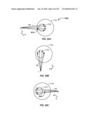 METHOD AND APPARATUS COORDINATING SYNCHROTRON ACCELERATION PERIODS WITH PATIENT RESPIRATION PERIODS diagram and image