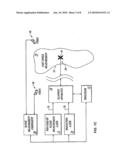 Controlling A Projected Pattern diagram and image