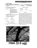 COMPOSITIONS AND METHODS FOR MACULAR DEGENERATION diagram and image