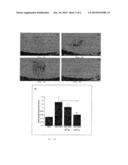 COMPOSITIONS AND METHODS FOR MACULAR DEGENERATION diagram and image