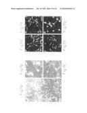 Method of inducing differentiation of bone marrow stromal cells to neural cells or skeletal muscle cells by introduction of Notch gene diagram and image