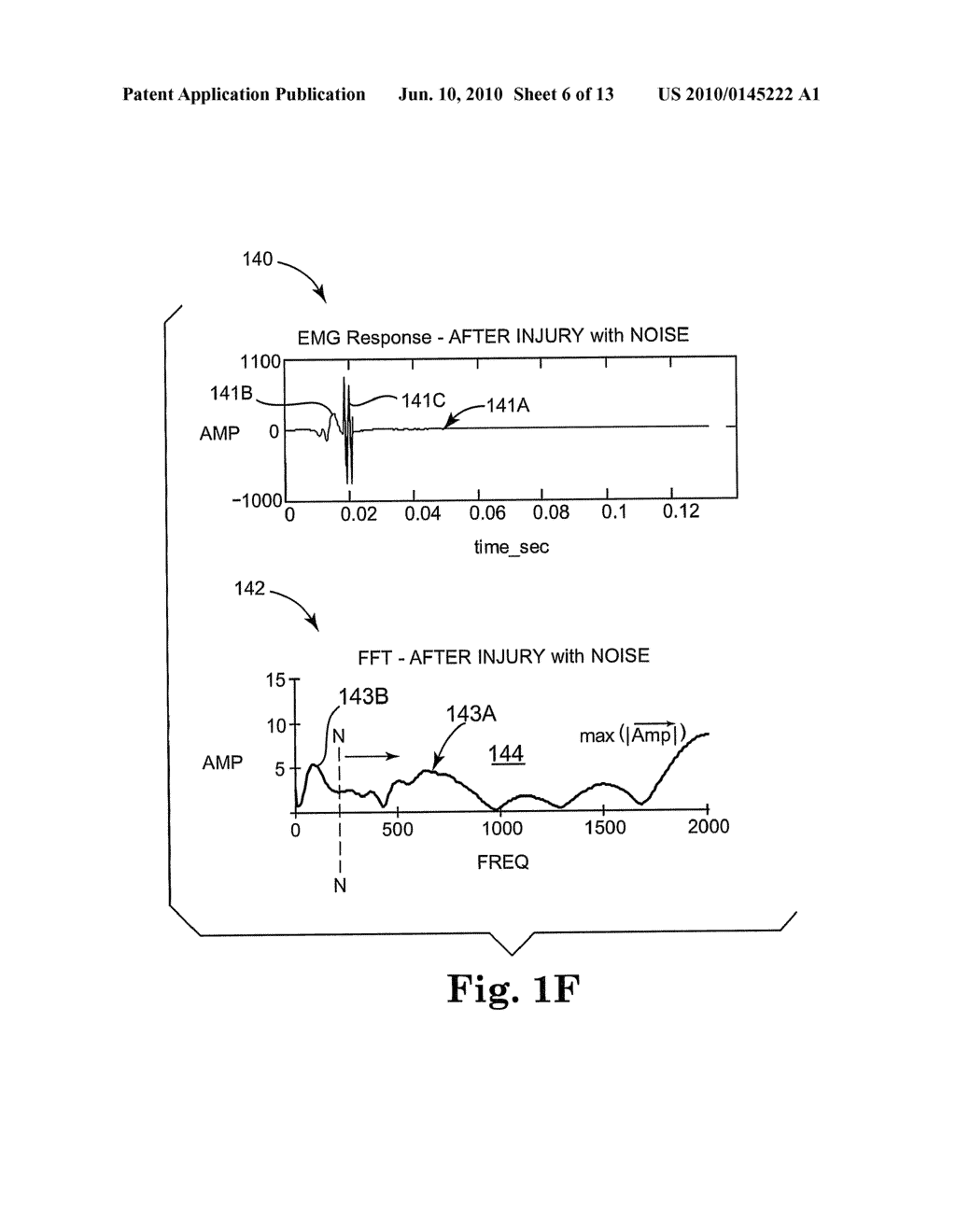 METHOD AND SYSTEM FOR MONITORING A NERVE - diagram, schematic, and image 07