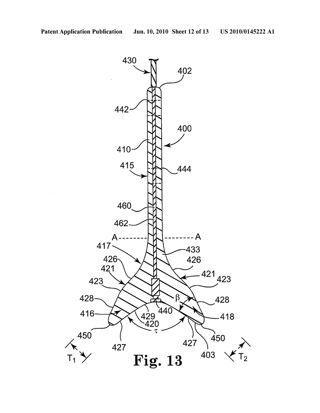 METHOD AND SYSTEM FOR MONITORING A NERVE - diagram, schematic, and image 13