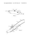 DUAL MODULUS BALLOON FOR INTERVENTIONAL PROCEDURES diagram and image