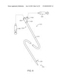 DUAL MODULUS BALLOON FOR INTERVENTIONAL PROCEDURES diagram and image