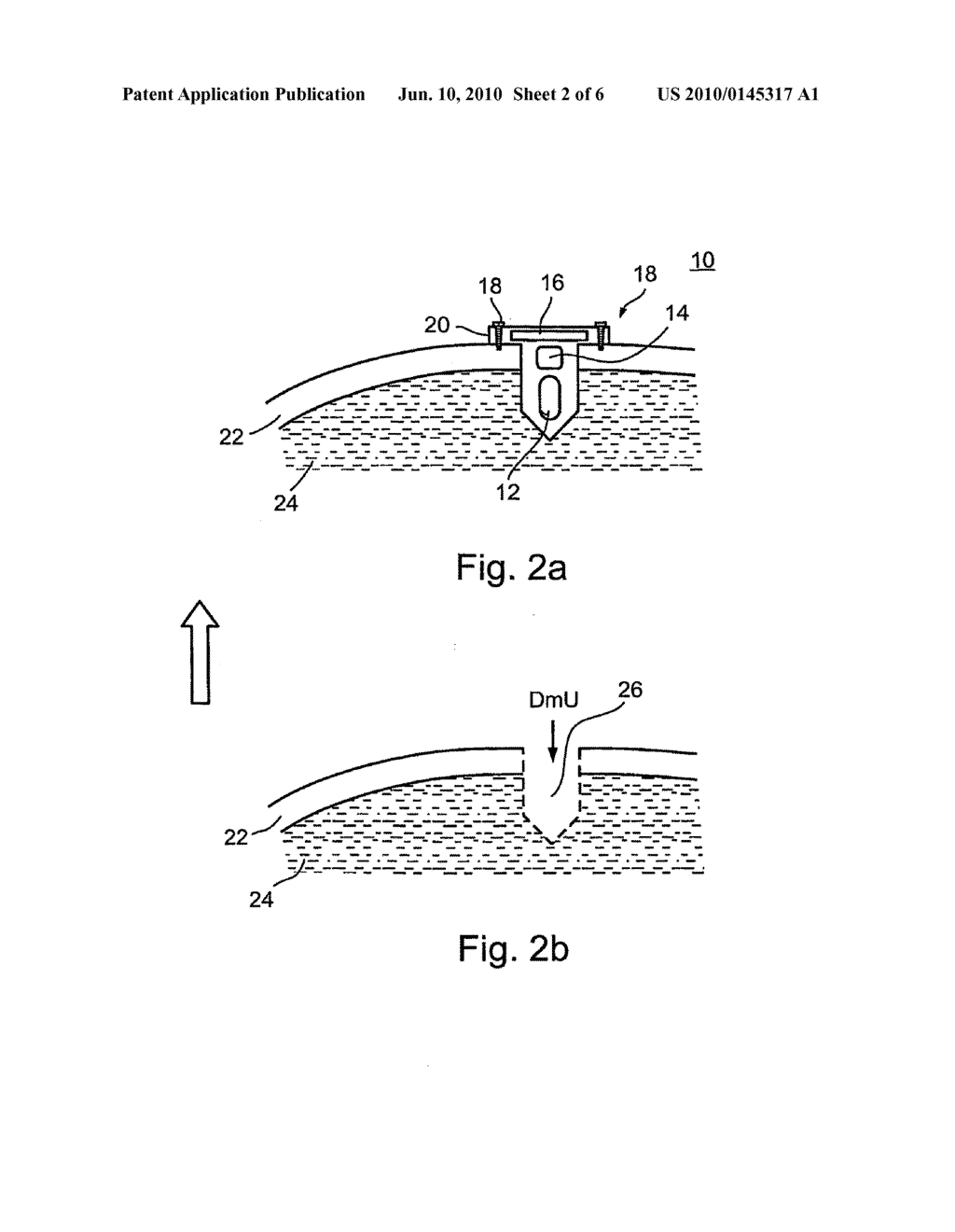 DEVICE SYSTEM AND METHOD FOR MONITORING AND CONTROLLING BLOOD ANALYTE LEVELS - diagram, schematic, and image 03