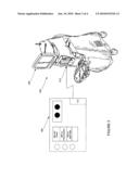 Surgical laser system with remote control functionality diagram and image